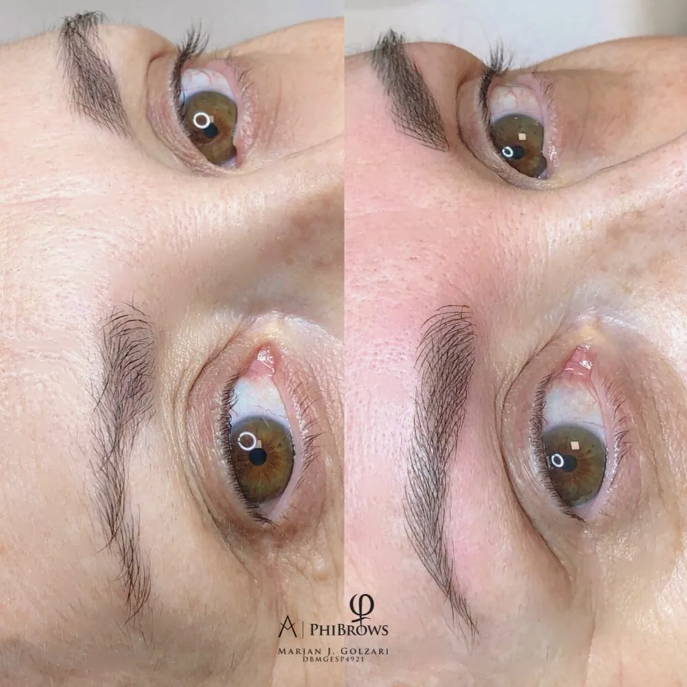 Antes y después de microblading de cejas, clienta 6